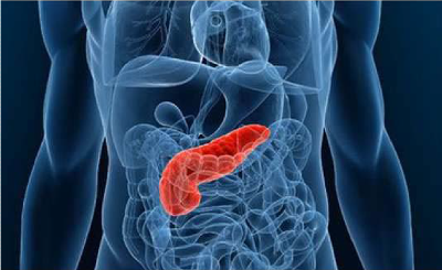 Pancreatic Cancer